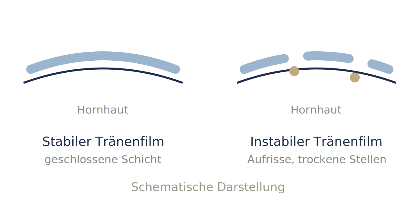Tränenfilm Diagramm